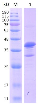 12% SDS-PAGE analysis profiles of purified NTHI0358-30-264 (CBB stained).